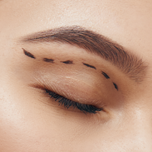 Medical aesthetics
